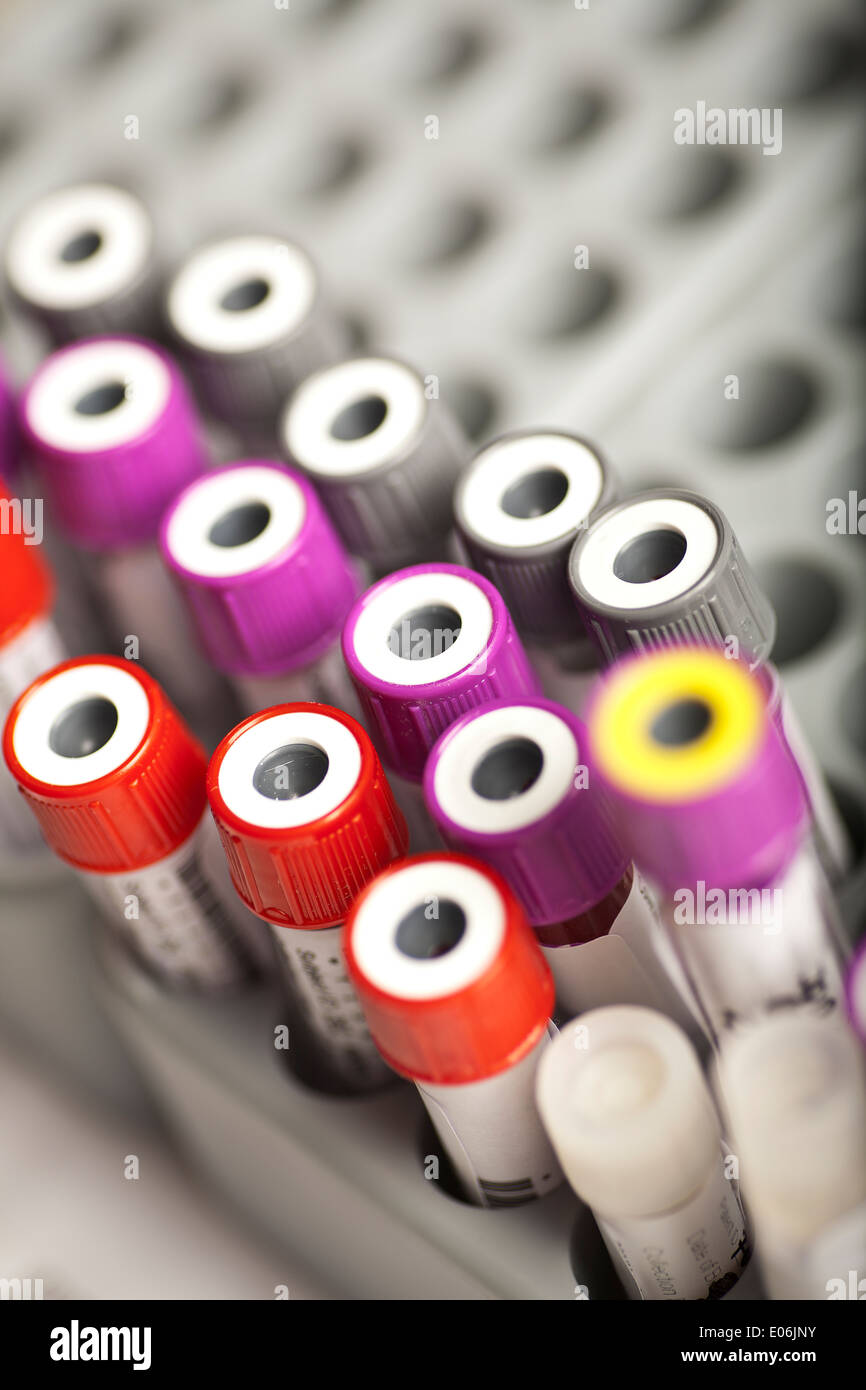 Échantillon de sang dans le bac des échantillons de laboratoire Banque D'Images