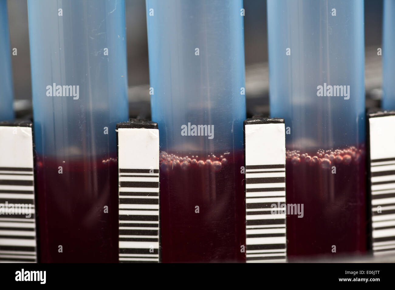 Échantillon de sang dans la centrifugeuse de laboratoire - close up Banque D'Images