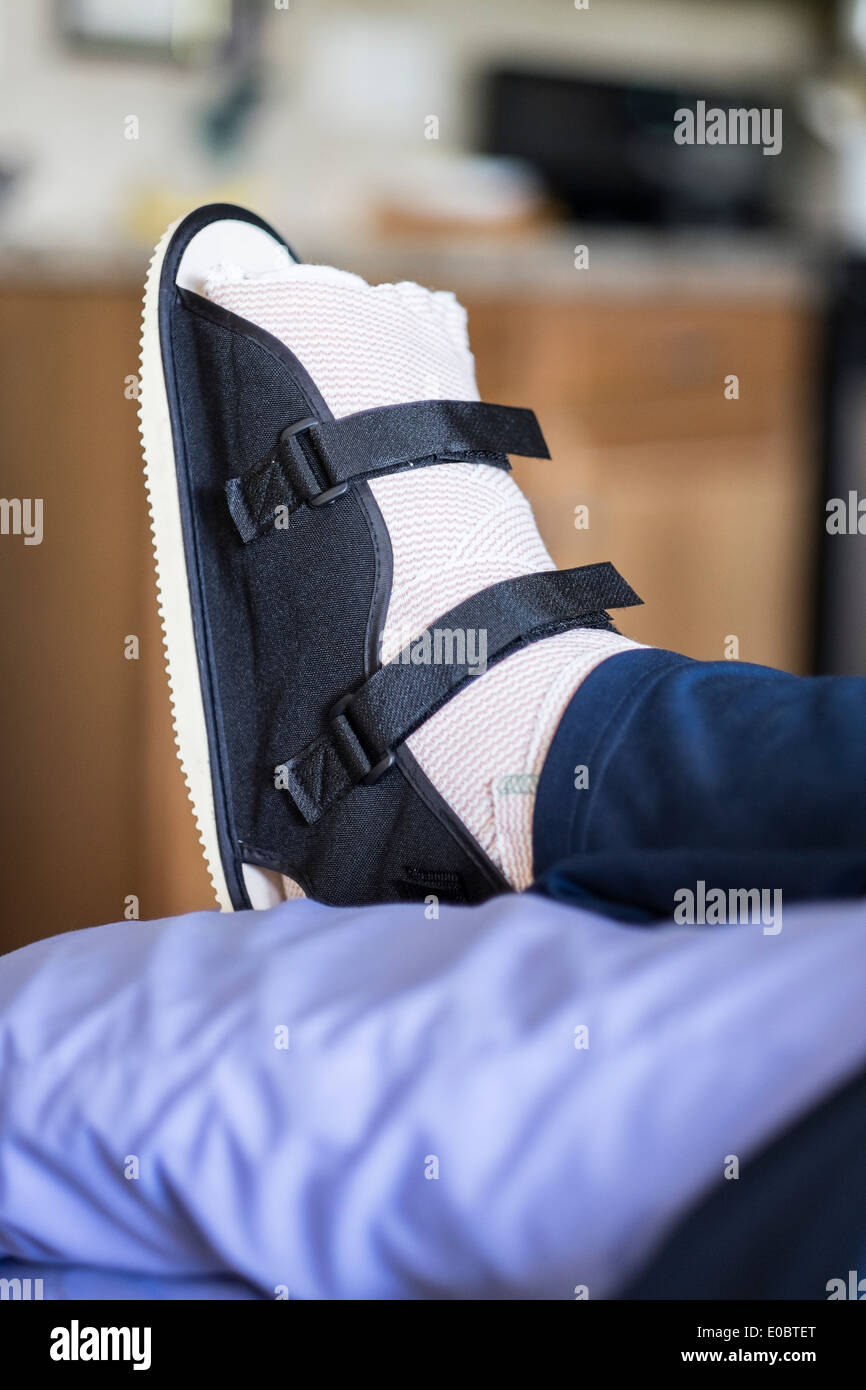 Au pied d'une femme de race blanche dans son 40s qui souffre de polyarthrite rhumatoïde, qui a subi une intervention chirurgicale sur ses orteils ce matin-là. Wichita, Kansas, États-Unis. Banque D'Images