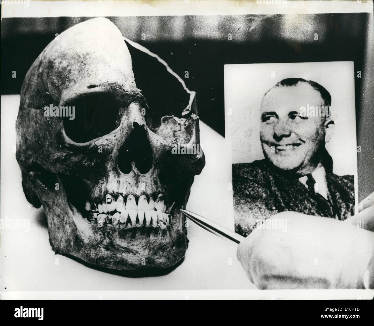 Le 12 décembre 1972 - Est ce crâne de Martin Bormann : deux os, un crâne et une cuisse n'a été trouvé dans les fouilles récentes à Berlin, Lehrt, où Martin Bormann, l'adjoint de Hitler, aurait été tué en 1945. Le ministère public de Francfort a envoyé la chirurgie-dentaire moule du leader Nazi à Berlin. La photo montre le crâne, avec des dents bien préservés, photographiée avec un photgraph de Martin Bormann. Banque D'Images