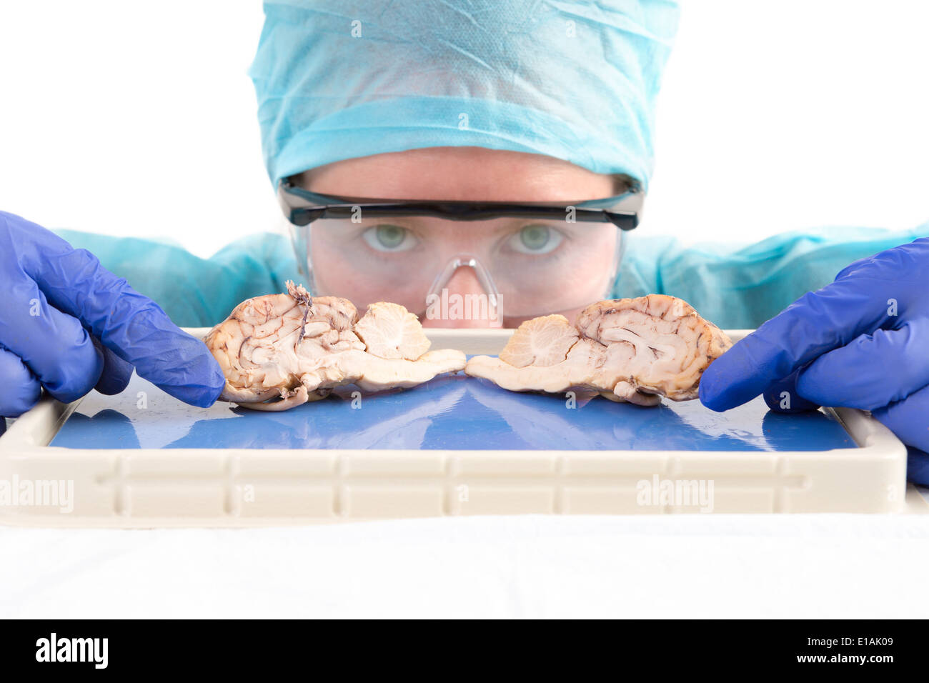 Anatomie féminine étudiant, technologiste médical ou avec un pathologiste vache disséqués par tranches de cerveau de la section intermédiaire pour montrer le Banque D'Images