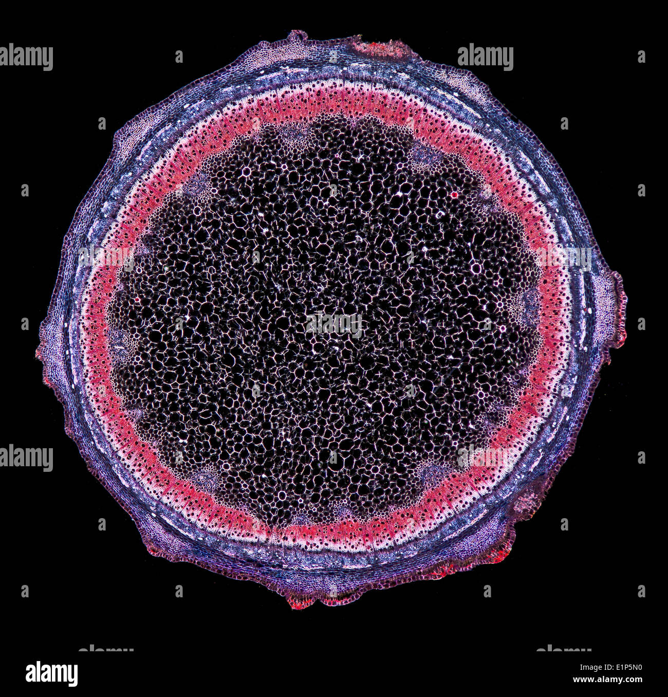 Darkfield photomicrographie de Sambucus nigra, le Sureau lenticelles tige, TS. Section Vitrail montrant physiologie Banque D'Images