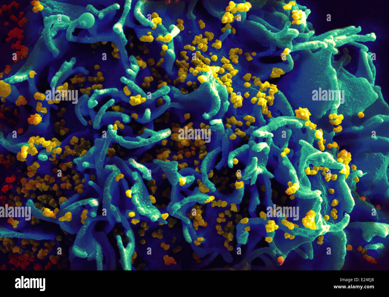 H infectés par le VIH des cellules T9 Banque D'Images