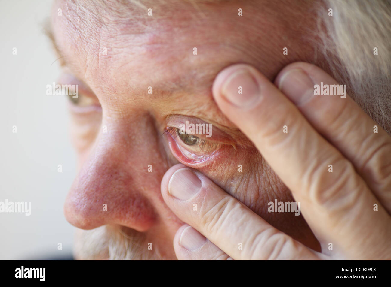 Homme plus âgé a la fatigue et la fatigue oculaire Banque D'Images