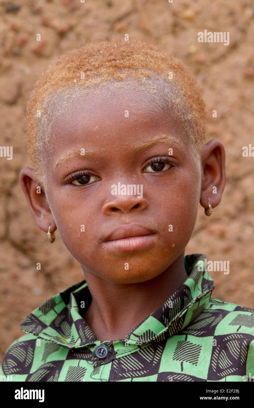 Le Burkina Faso, région sénoufo, village de Negueni, peu d'albino girl Banque D'Images