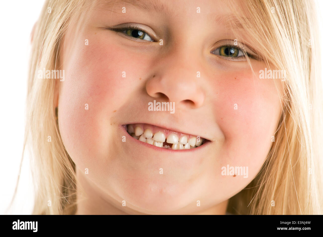 La petite fille aux dents manquantes Banque D'Images