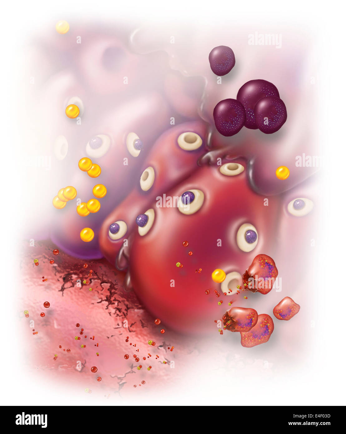 Tissu environnant devient enflammée causant plusieurs effets systémiques tels que la vasodilatation, la sécrétion de mucus, la stimulation de nerf Banque D'Images