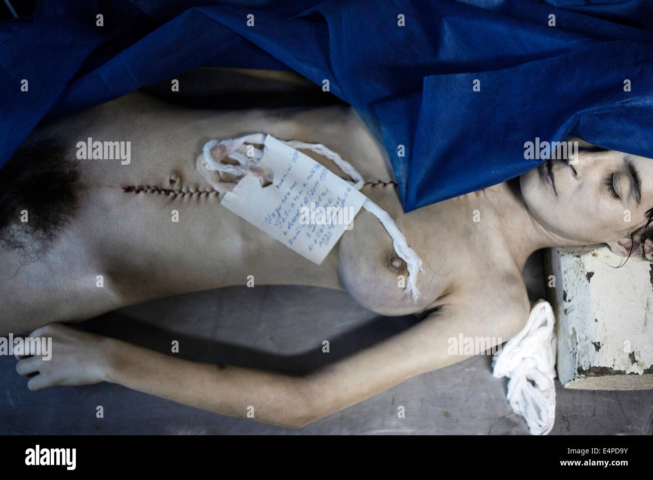 La tuberculose et le VIH en Moldova, la morgue de l'hôpital, Draganiuc Chiril Chișinău, Moldova Banque D'Images