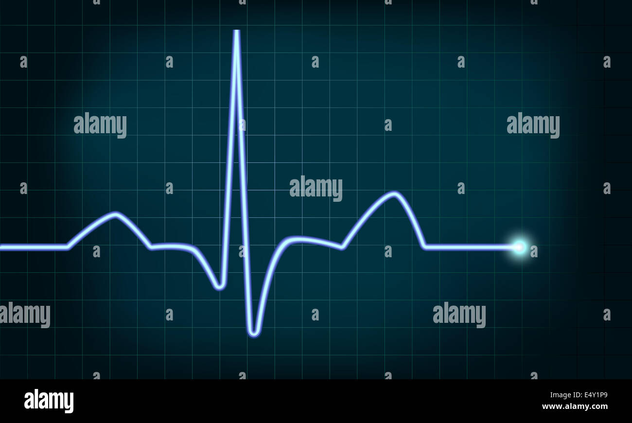 heartbeat curve Banque D'Images