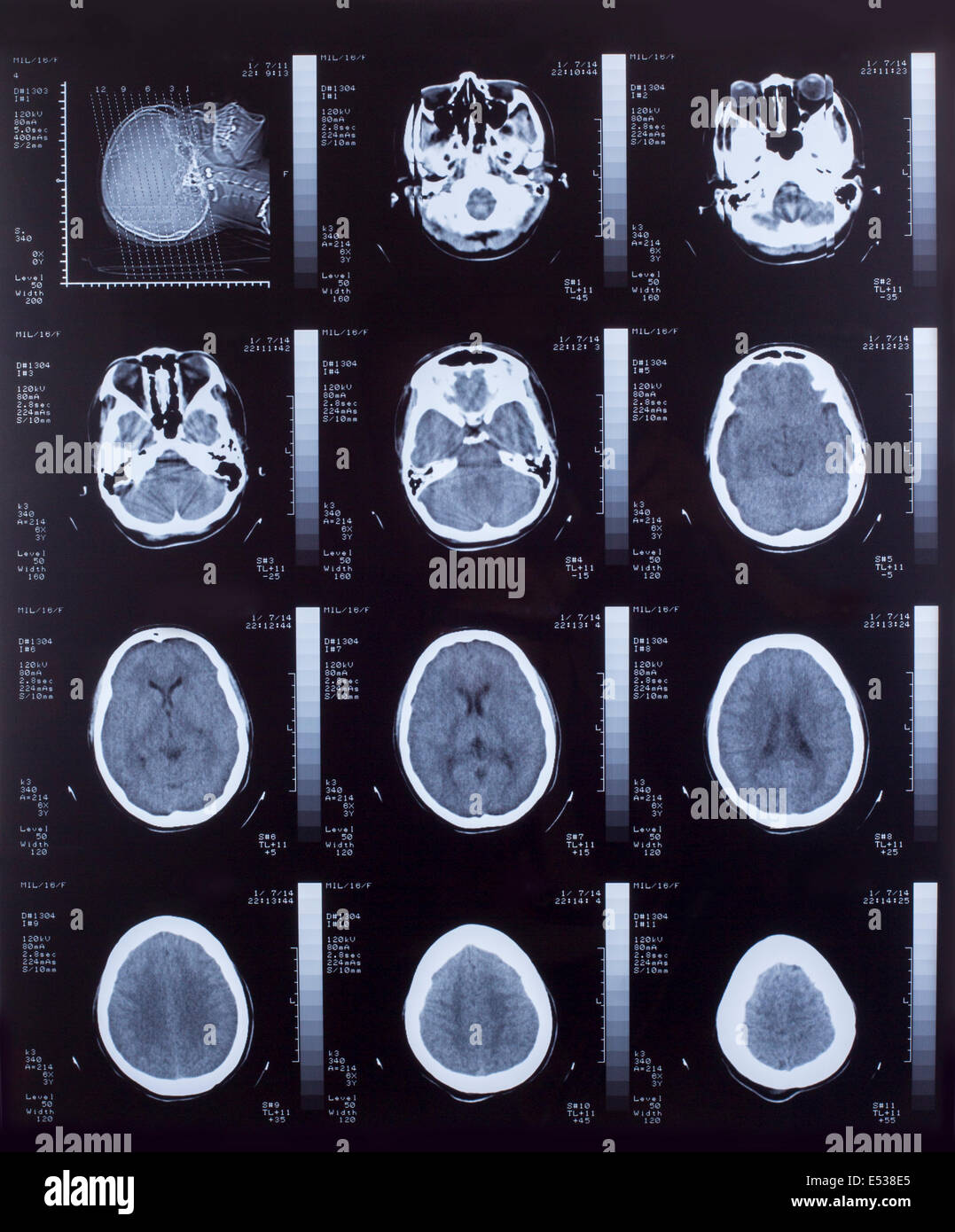 Libre d'un scanner CT avec cerveau Banque D'Images