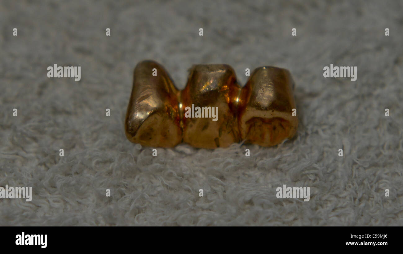 Photo par:Jules Annan photo montre:or véritable caps dentaires qui ont été enlevés par les Nazis de détenus juifs à leur arrivée à Auschwitz pendant l'holocauste ; ans Date 07/07/2014 Banque D'Images