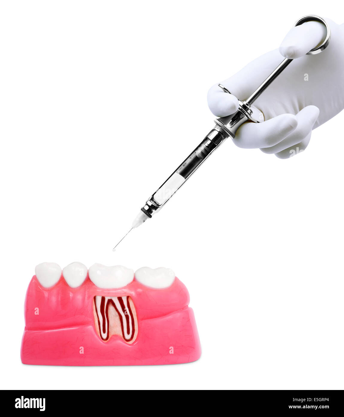 Traitement dentaire Banque D'Images