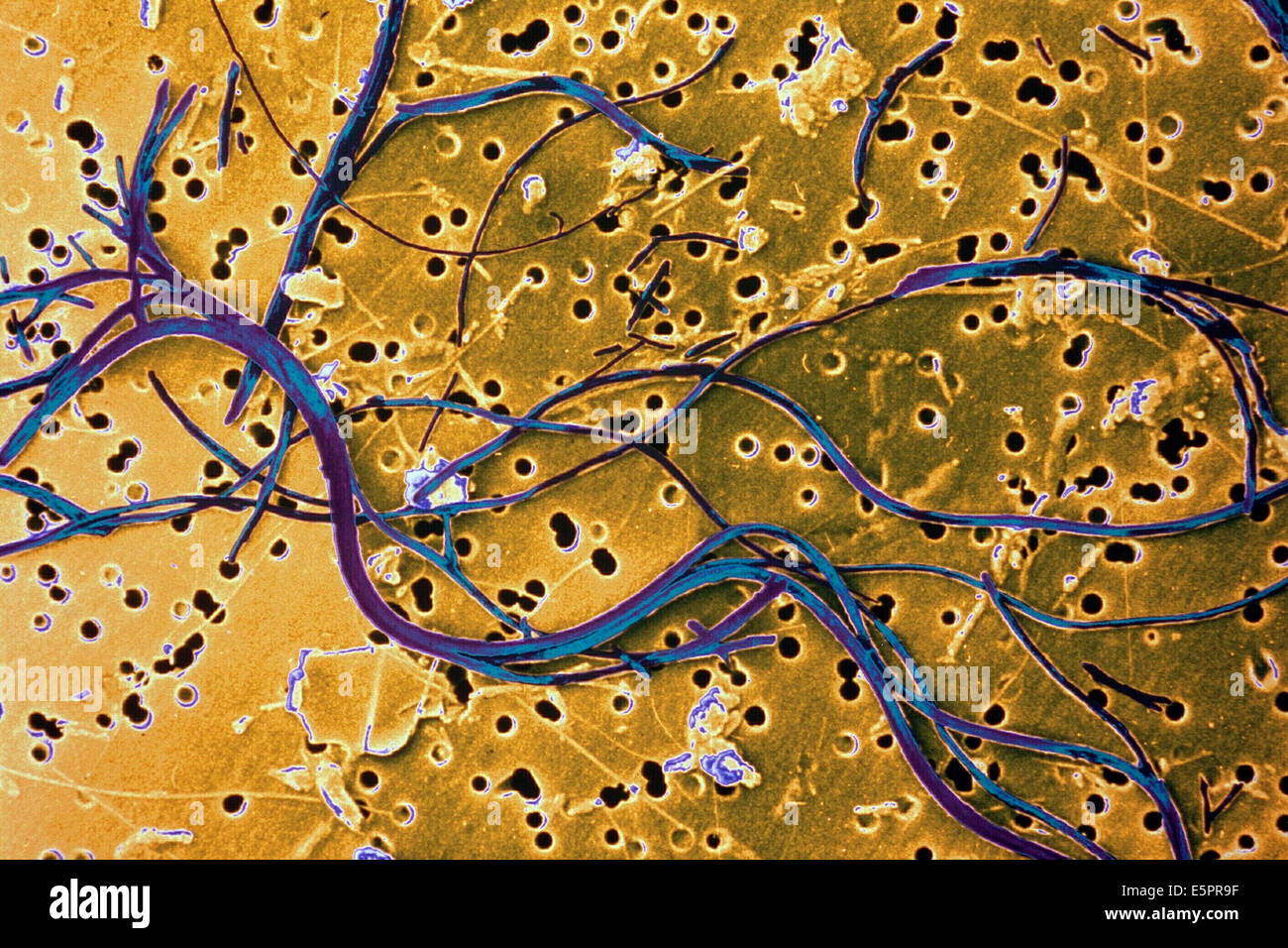 les-fibres-d-amiante-esm-microscope-lectronique-balayage-x3000