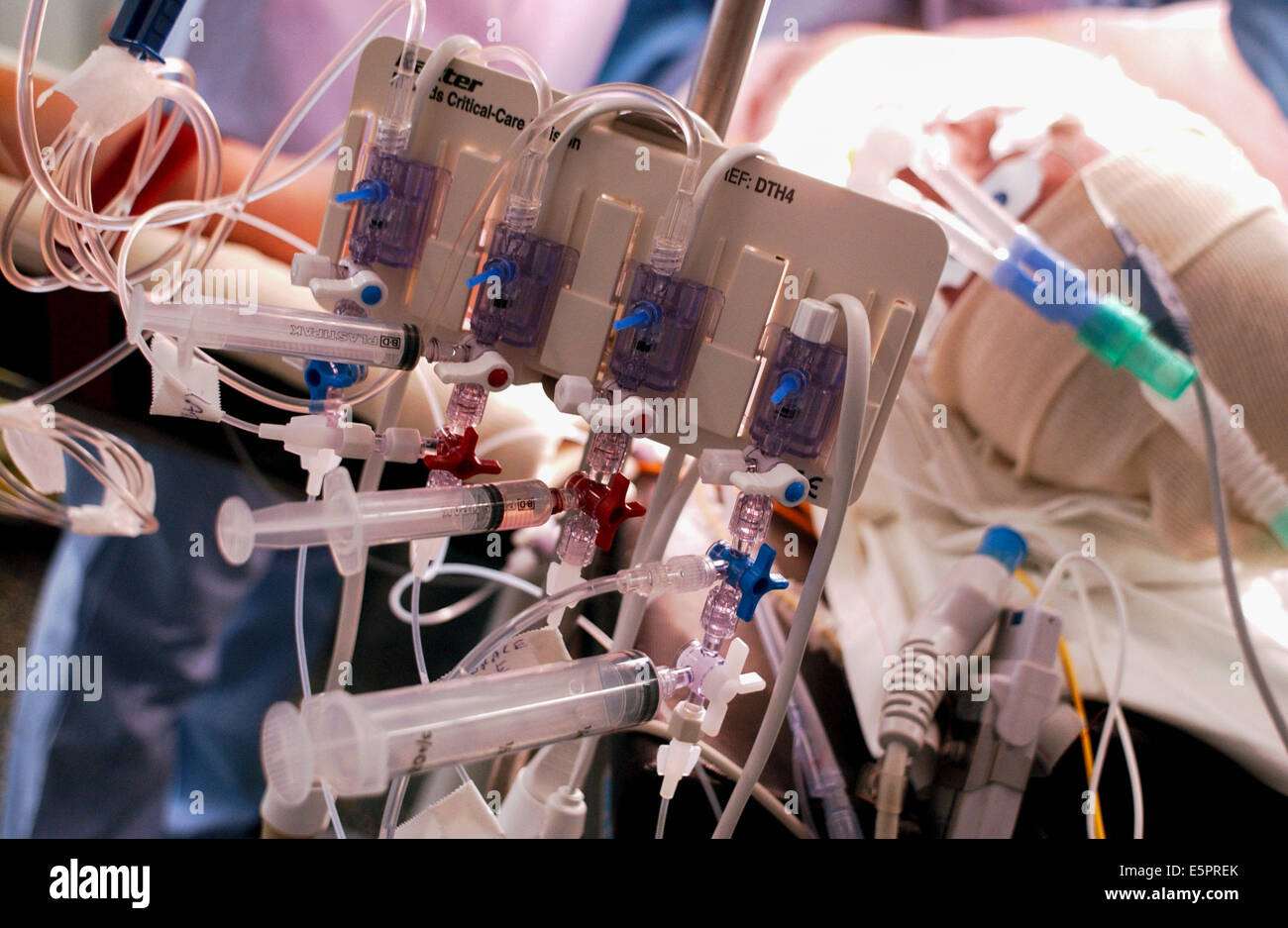 Anesthésie. Banque D'Images