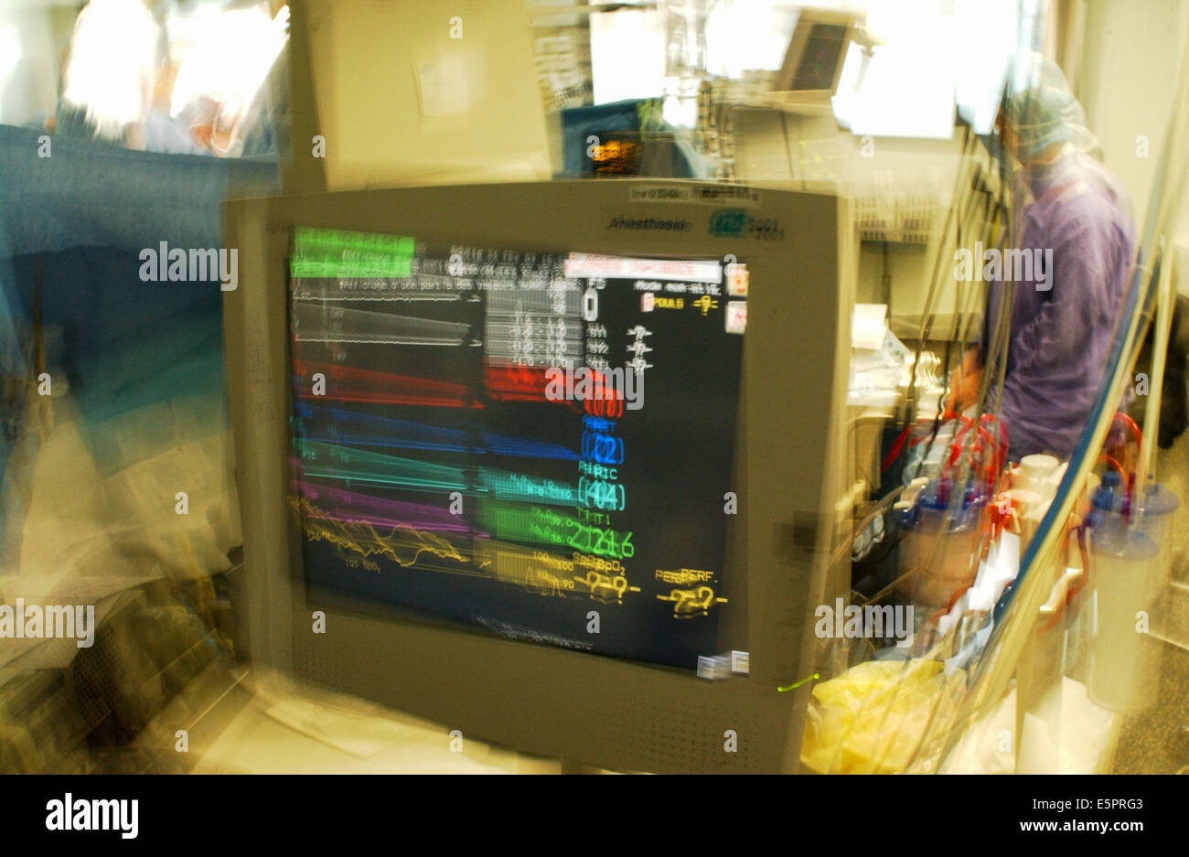 L'écran de surveillance de l'anesthésie. Banque D'Images