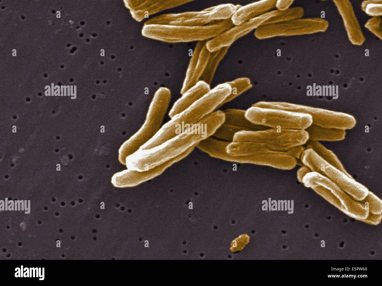 L'analyse des électrons Microphotographie (SEM) de bactéries Gram-positives bacilles Mycobacterium tuberculosis, l'agent causal de la tuberculose. Banque D'Images