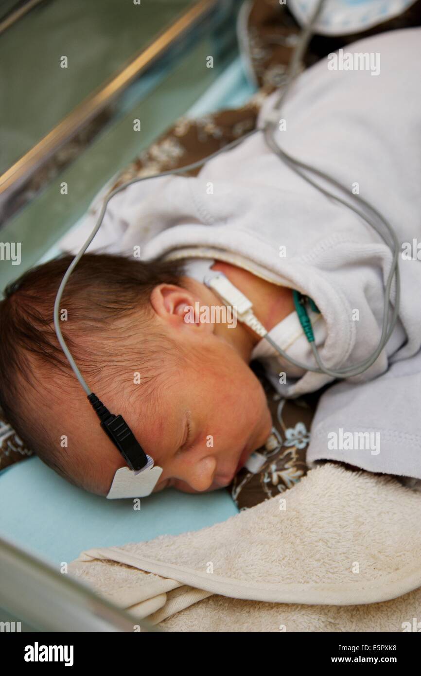 Jour 2 En Bebe De Test De Depistage De La Surdite A La Methode Des Potentiels Evoques Auditifs Pea Qui Analyse Les Photo Stock Alamy