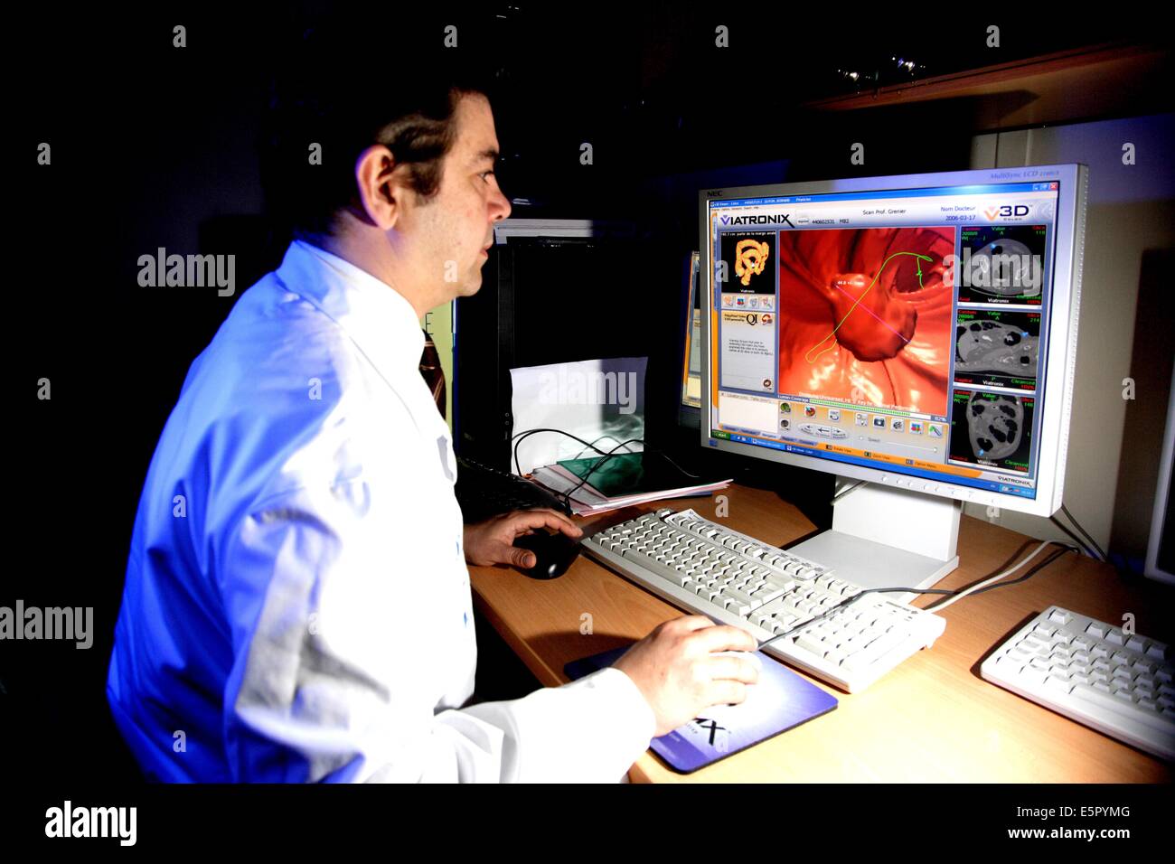 Service de radiologie, Hôpital Pitié-Salpêtrière, Paris, France, la  coloscopie virtuelle permet la reconstruction en 3D Photo Stock - Alamy