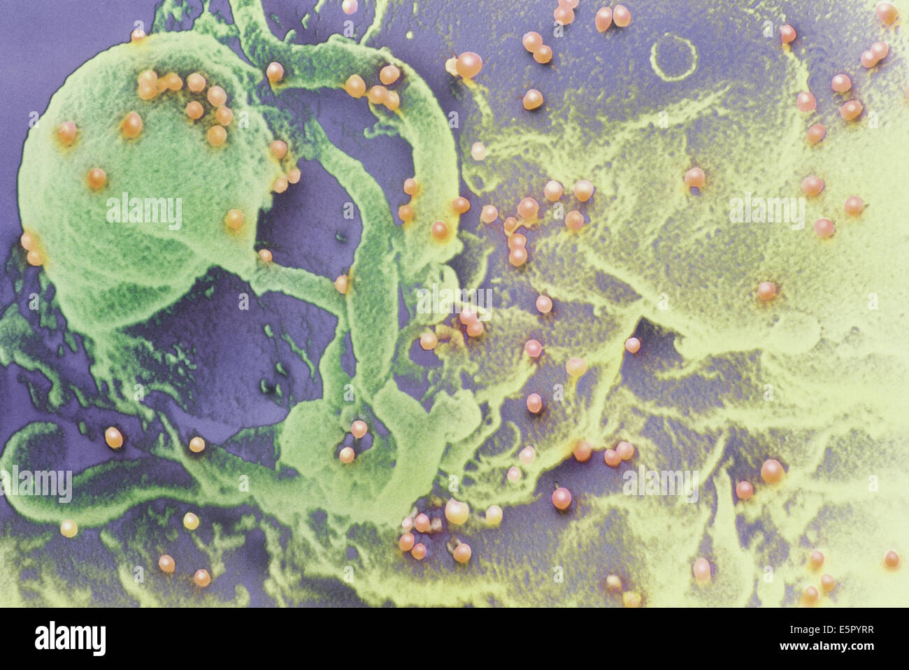 Couleur de l'analyse des électrons Microphotographie du virus VIH (points rouges) à partir d'un bourgeonnement T-lymphocyte globules blancs (jaune et vert). Banque D'Images