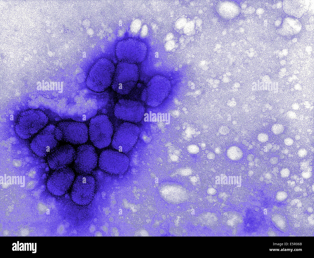 Micrographie électronique à transmission (TEM) de virus de la variole. Banque D'Images