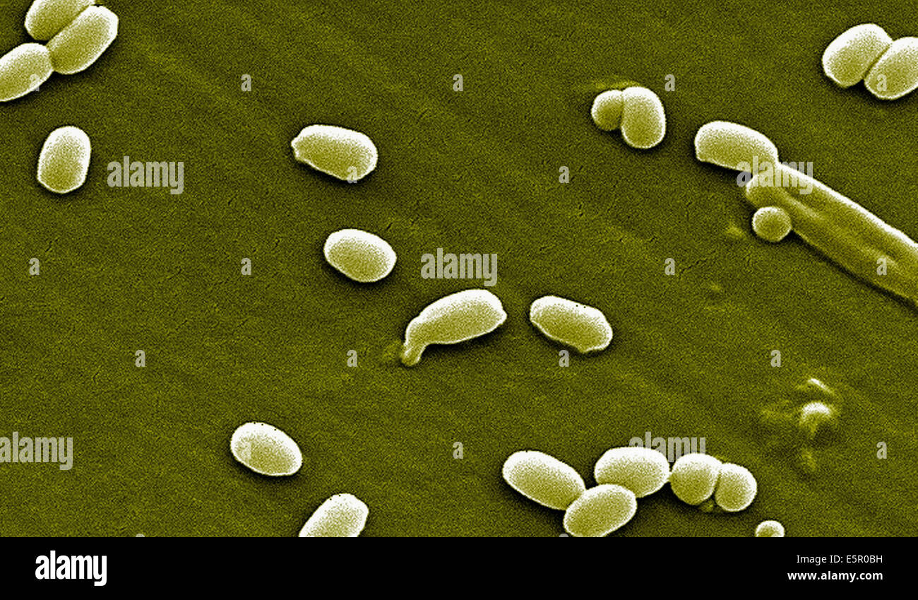 Micrographe de spores de Bacillus anthracis, une bactérie Gram-positives de bactéries qui est hautement pathogène et les causes Banque D'Images