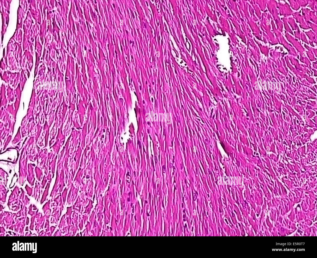 Photomicrographie de fibres du muscle cardiaque. Banque D'Images