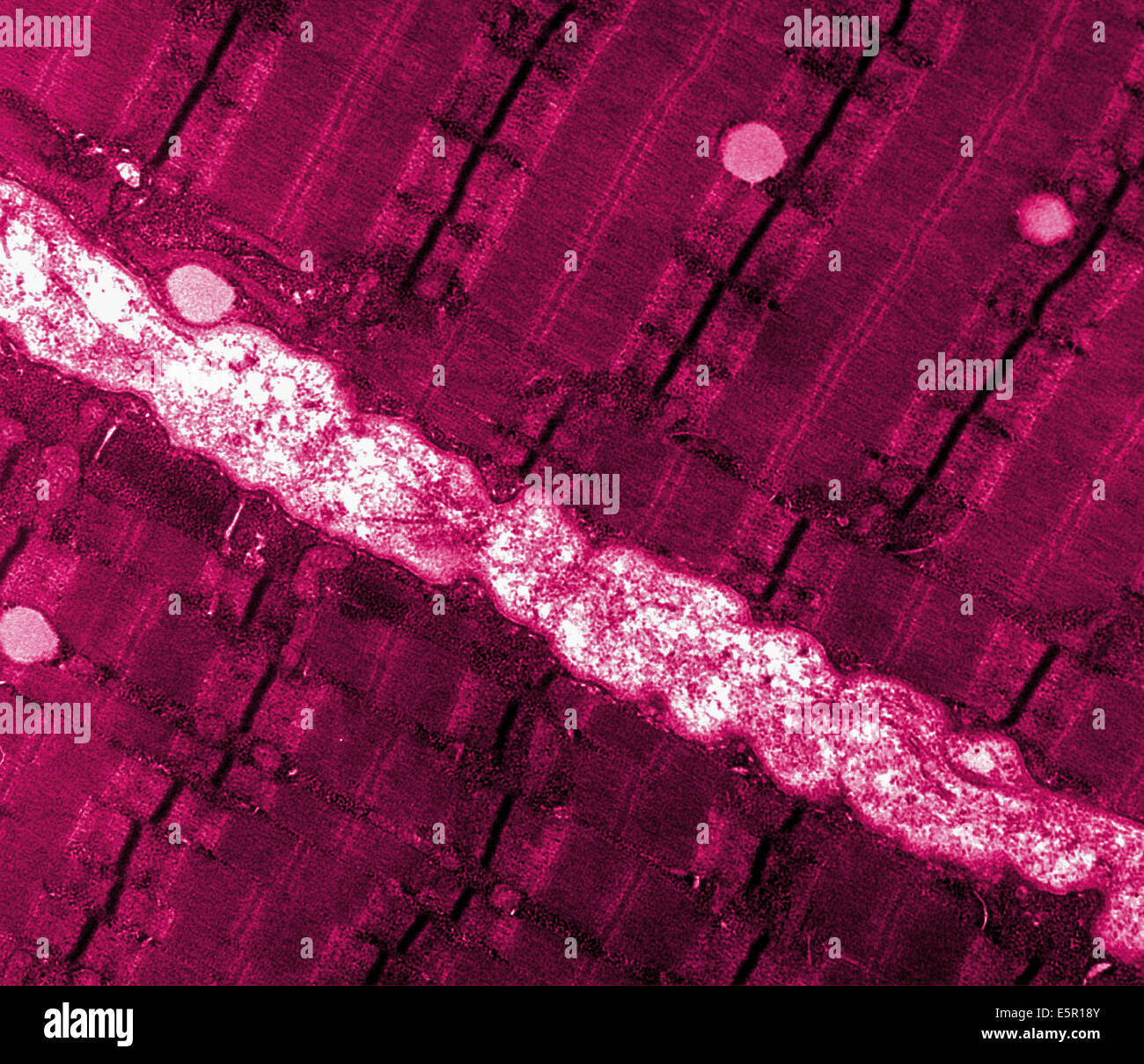 Micrographie électronique à transmission (TEM) d'une fine coupe longitudinale à travers une zone de tissu musculaire squelettique humain. Banque D'Images