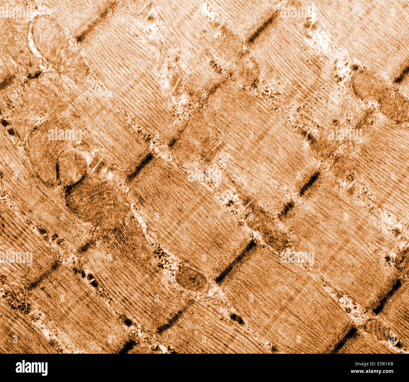 Micrographie électronique à transmission (TEM) du muscle squelettique aussi appelée musculus skeleti d'un hamster tongu, agrandissement Banque D'Images