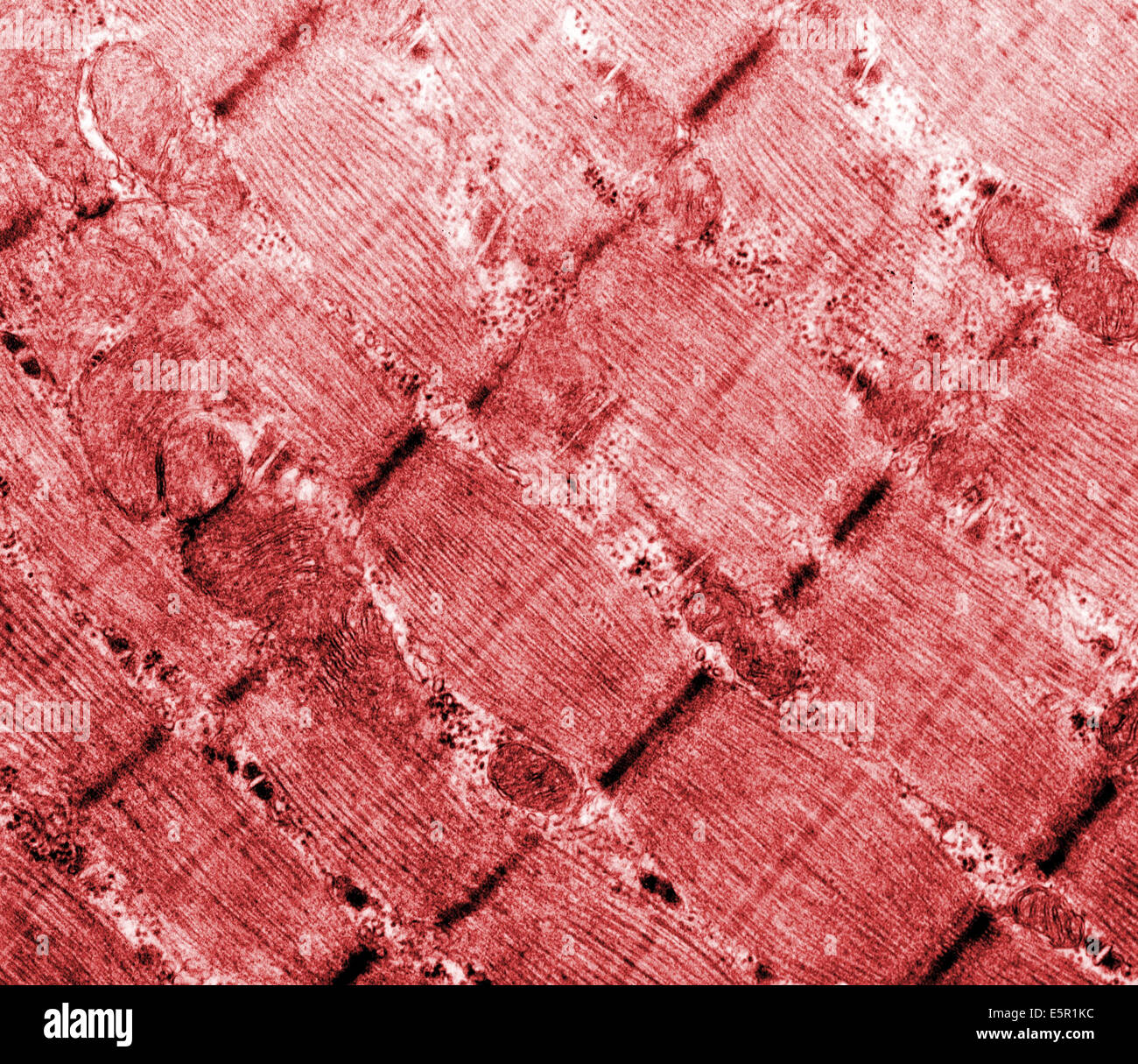 Micrographie électronique à transmission (TEM) du muscle squelettique aussi appelée musculus skeleti d'un hamster, agrandissement de la flèche Banque D'Images