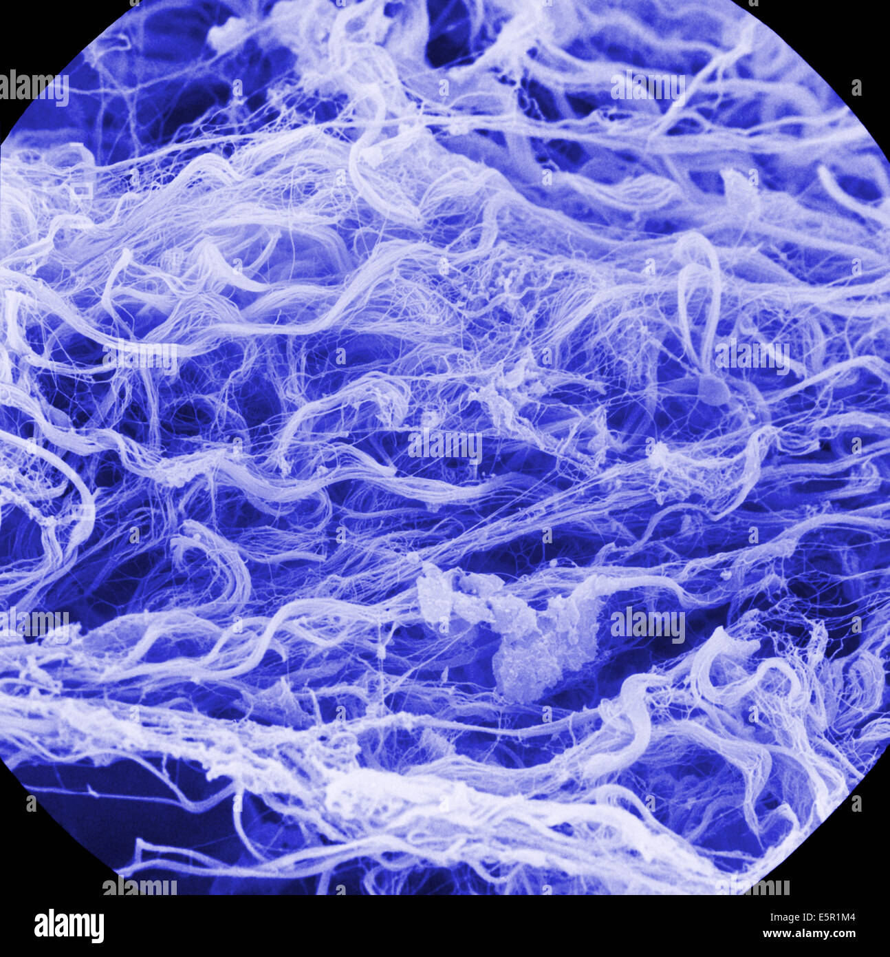 L'analyse des électrons Microphotographie (SEM) de fibres de collagène, grossissement x1000. Banque D'Images