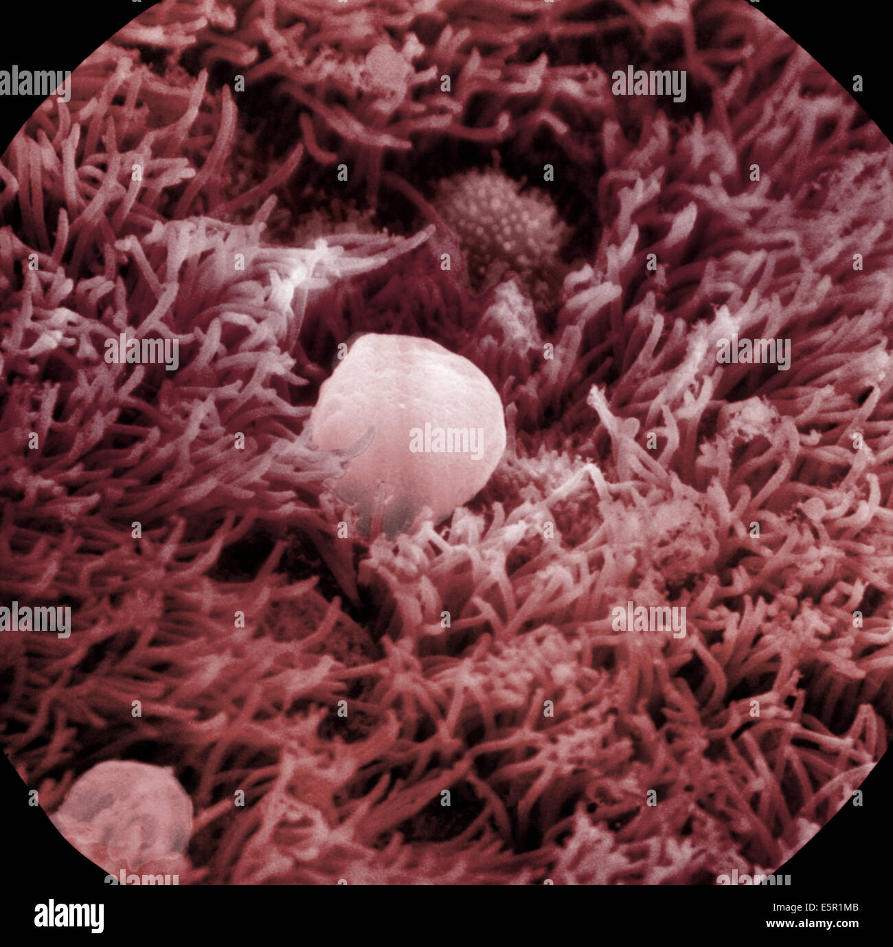 L'analyse des électrons Microphotographie (SEM) de la paroi des bronches, consistant en cellules ciliées, au centre, un gobelet d'un expulsing cellulaire Banque D'Images