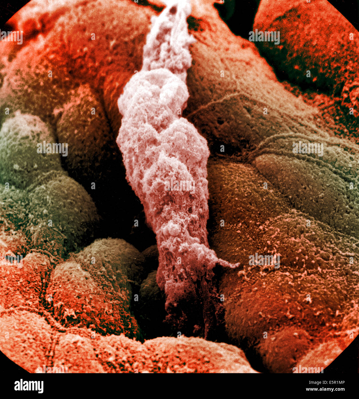 L'analyse des électrons Microphotographie (SEM) de la paroi de l'estomac bordée de cellules épithéliales produisant du mucus, au centre, une goutte de sécrétion Banque D'Images