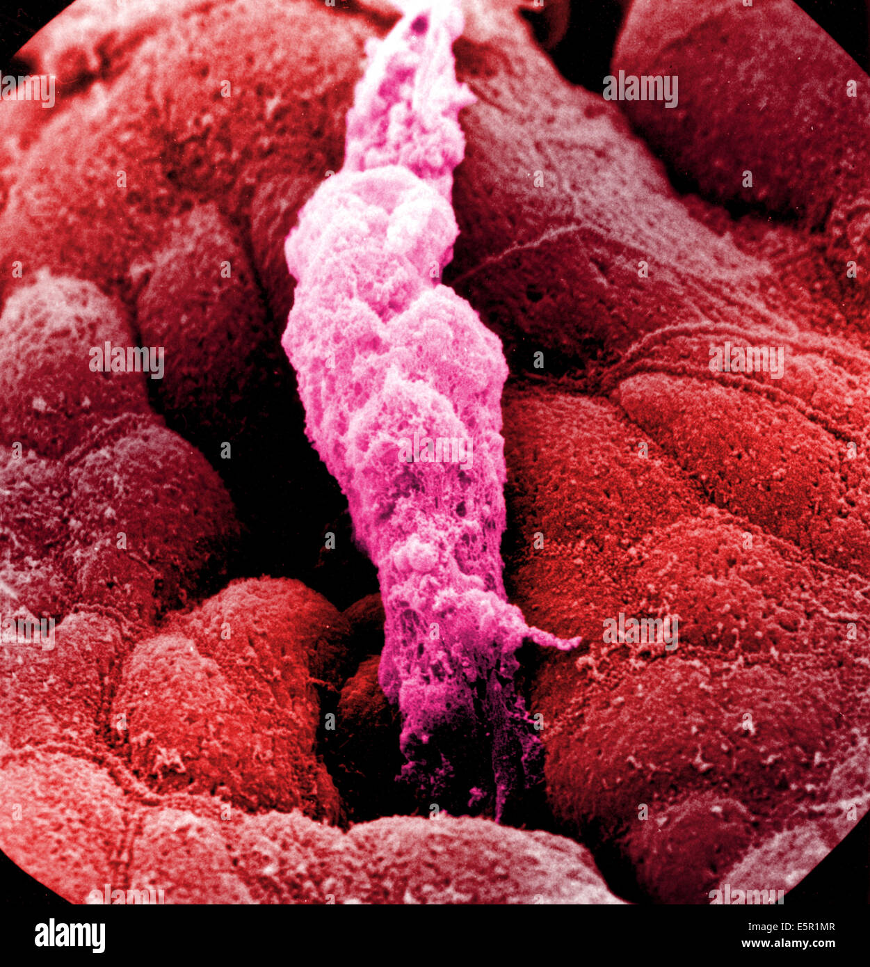 L'analyse des électrons Microphotographie (SEM) de la paroi de l'estomac bordée de cellules épithéliales produisant du mucus, au centre, une goutte de sécrétion Banque D'Images