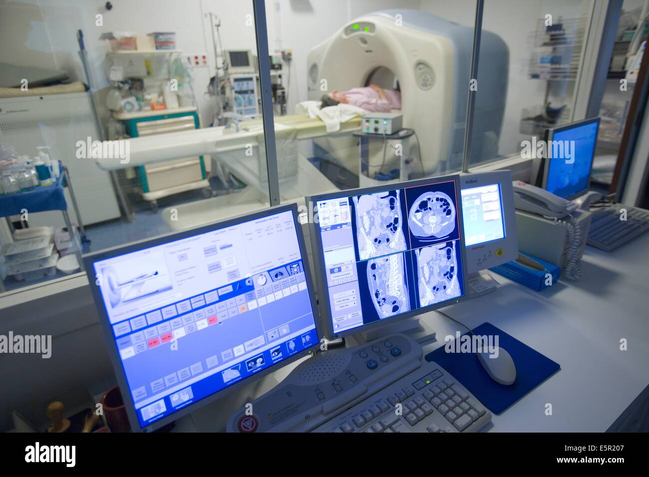 Ministère de l'imagerie médicale, hôpital de l'université de Rennes, France, patient en cours d'un colonoscop virtuel, le virtuel Banque D'Images