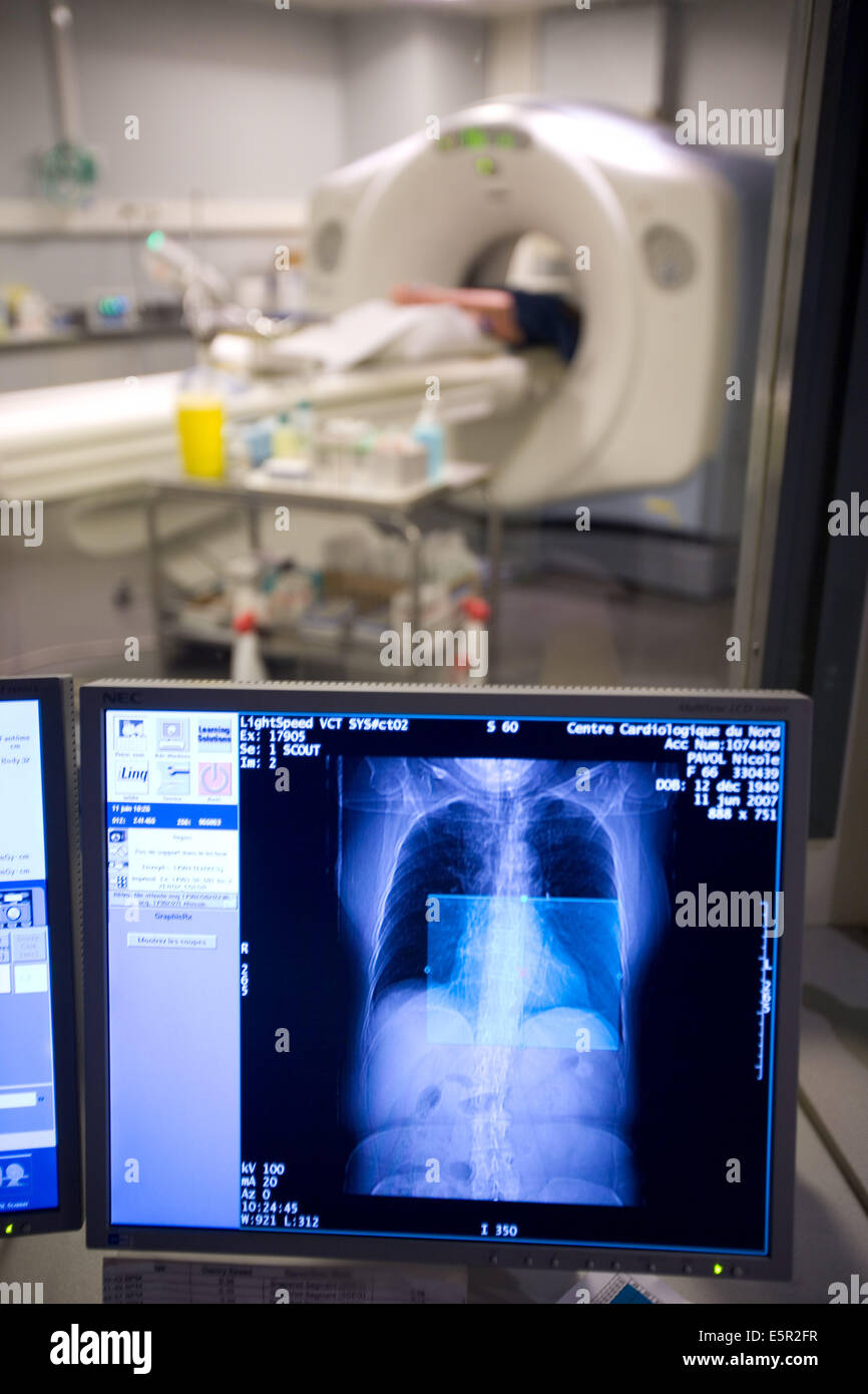 Patient en cours d'coeur 3D CT scan, Ministère de l'imagerie médicale, centre cardiologique du Nord, Saint Denis, France. Banque D'Images
