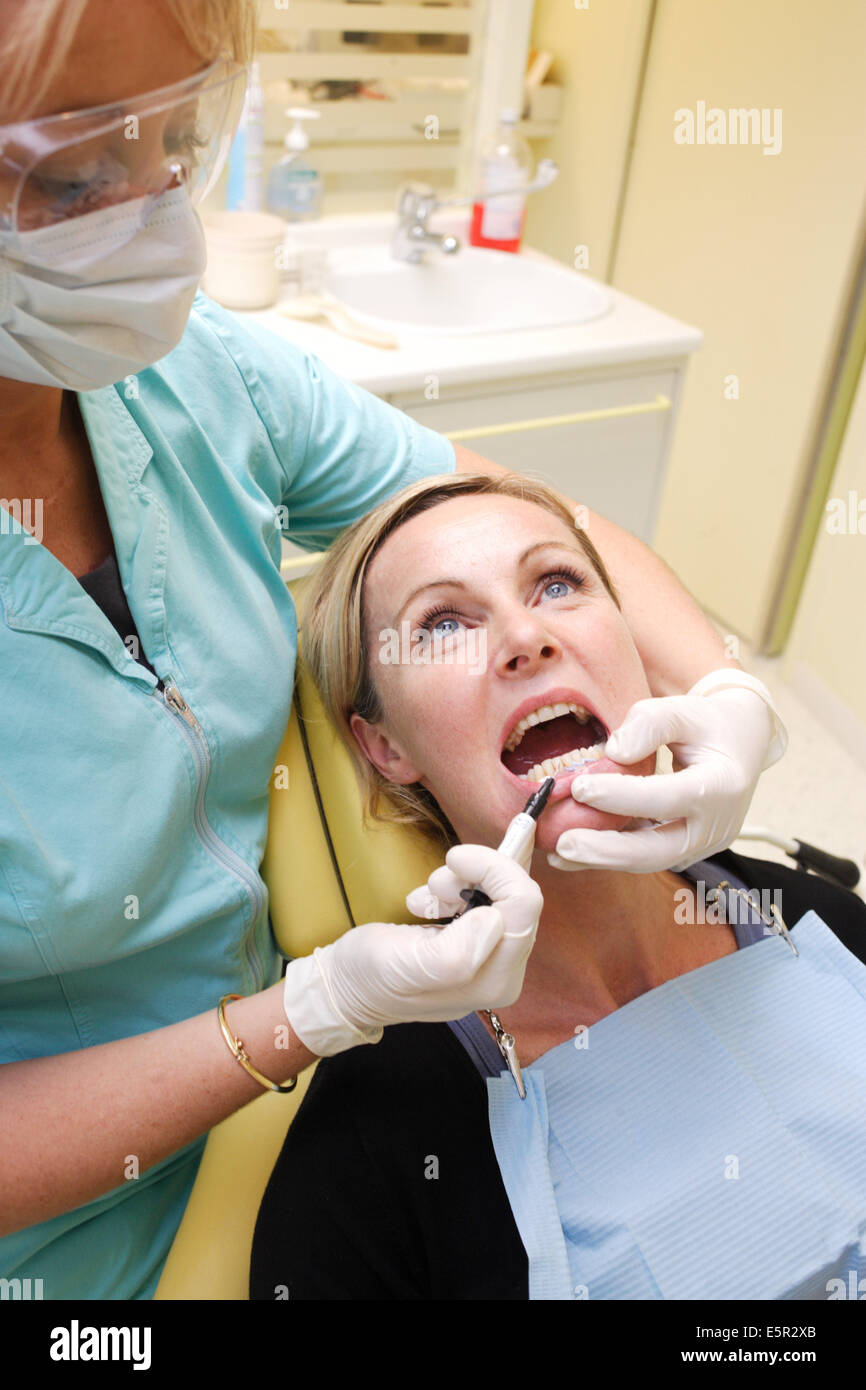 Un dentiste est de placer un capuchon pour protéger l'attelle dentaire les  gencives du patient pendant la procédure. withening dents Photo Stock -  Alamy