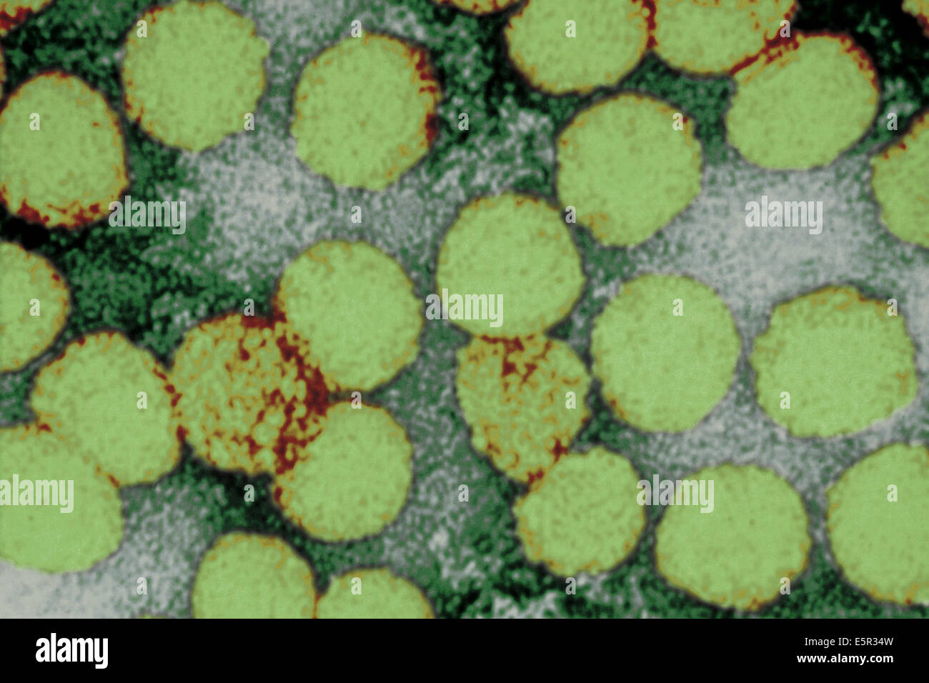 Renforcement de couleur micrographie électronique à transmission (TEM) de virus de la fièvre jaune, transmise à l'homme par l'Aedes aegypti Banque D'Images