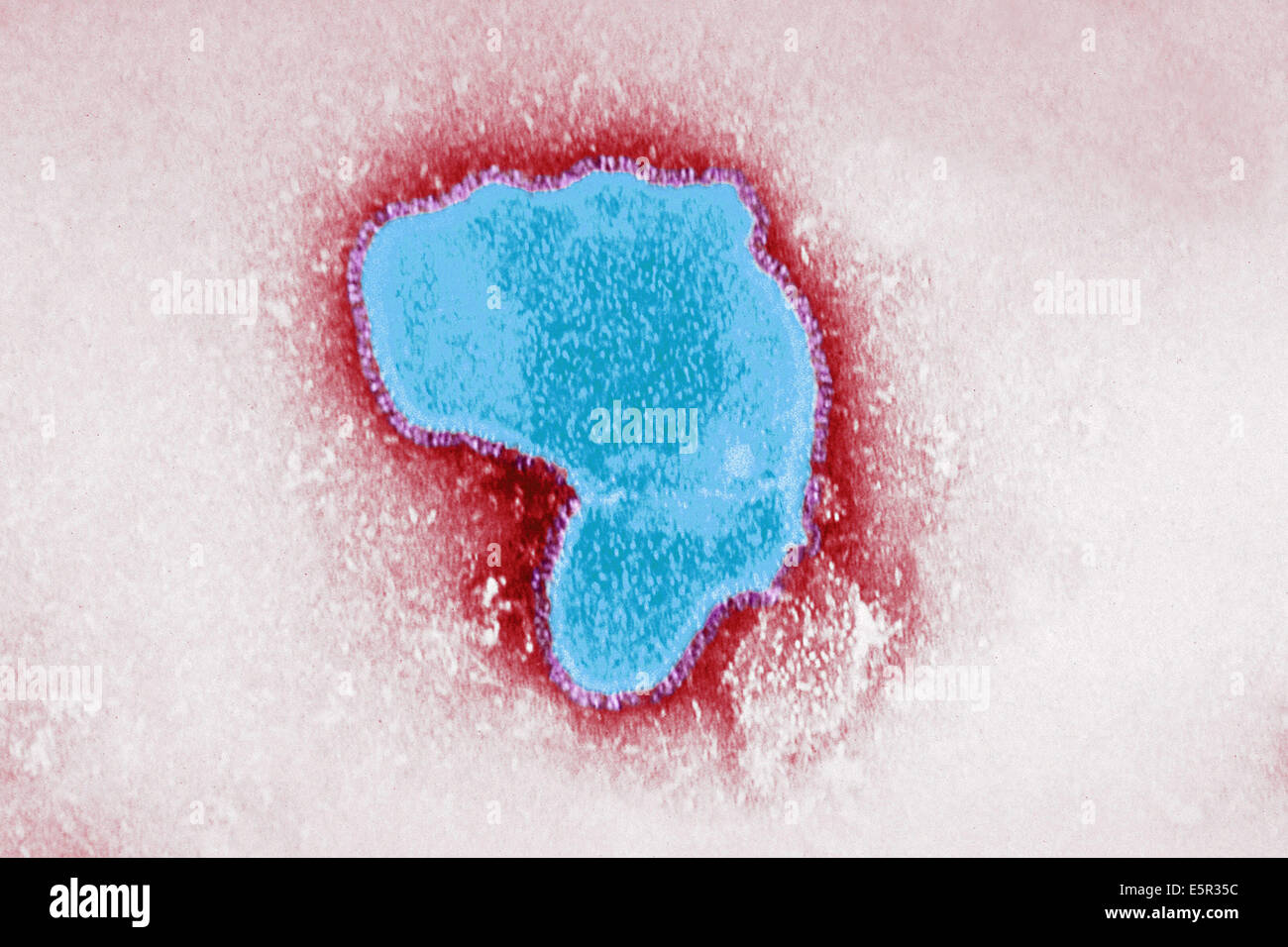 Renforcement de couleur micrographie électronique à transmission (TEM) de virus respiratoire syncytial (VRS), un paramyovirus, le VRS est le seul Banque D'Images