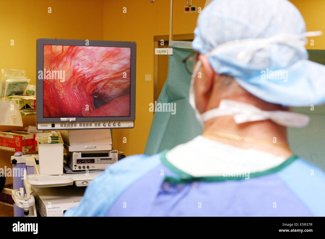 Traitement de l'affection des organes abdominopelvic avec coeliosurgery, Département de gastro-entérologie, chirurgie, hôpital de Limoges Banque D'Images