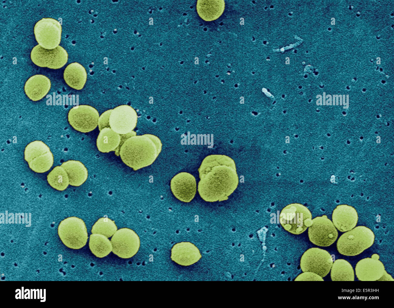 Élancé couleur de l'analyse des électrons Microphotographie (SEM) des Staphylococcus aureus, ces bactéries à Gram positif sont couramment Banque D'Images