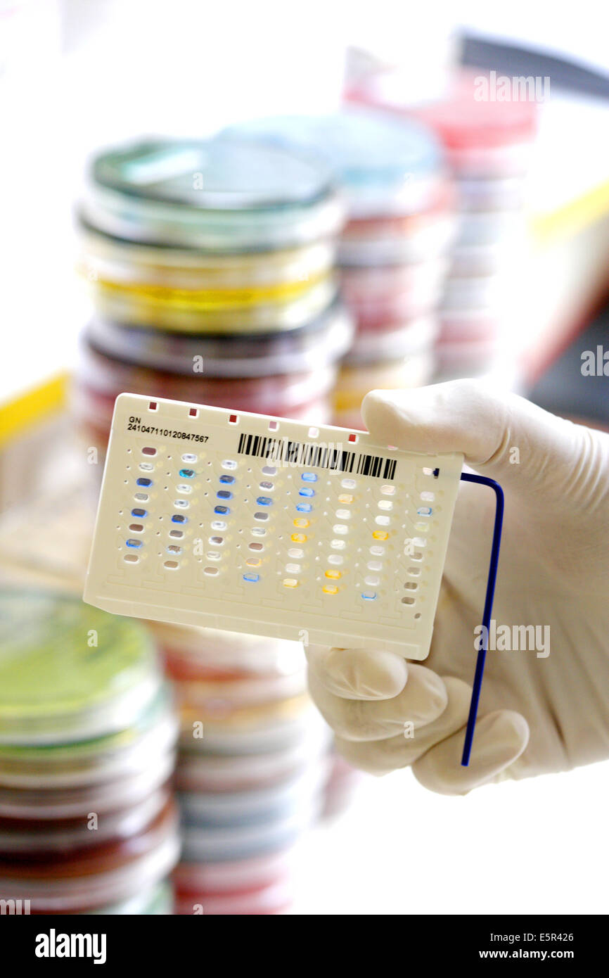 Laboratoire d'analyses médicales de l'hôpital, la lecture profil analytique Index (API) test pour identifier les bactéries. Banque D'Images