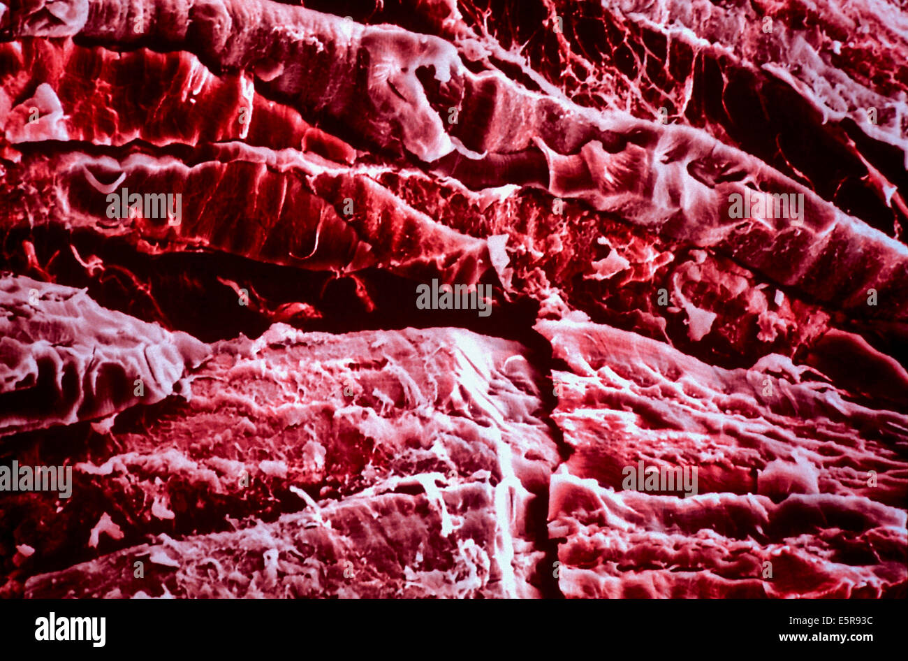 Couleur de l'analyse des électrons Microphotographie (SEM) de tissu musculaire la dystrophie musculaire, Grossissement 300x. Banque D'Images