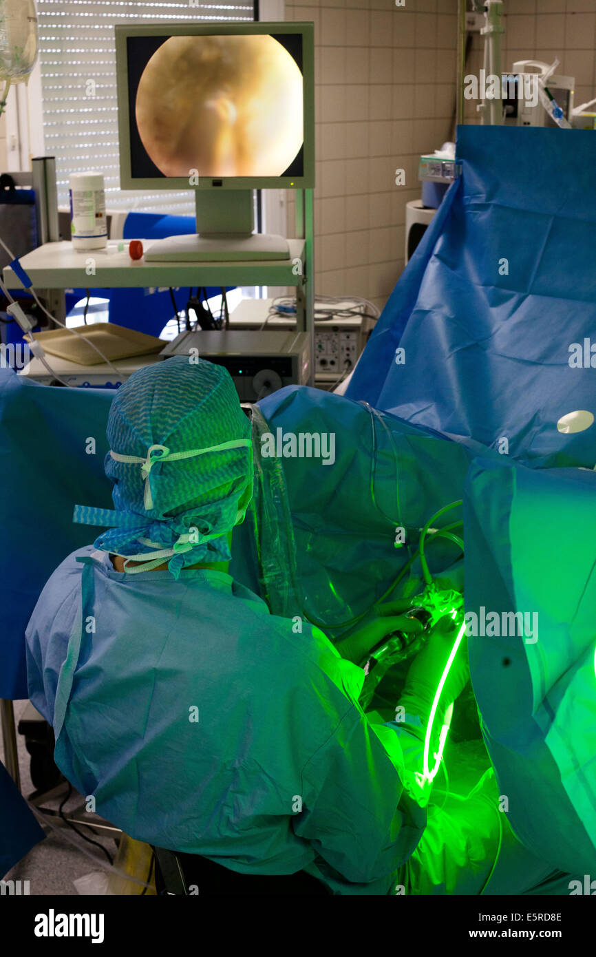 Le traitement de l'Hyperplasie prostatique) par Photoselective vaporisation de la prostate (PVP) à l'aide de la PV Greenlight Banque D'Images