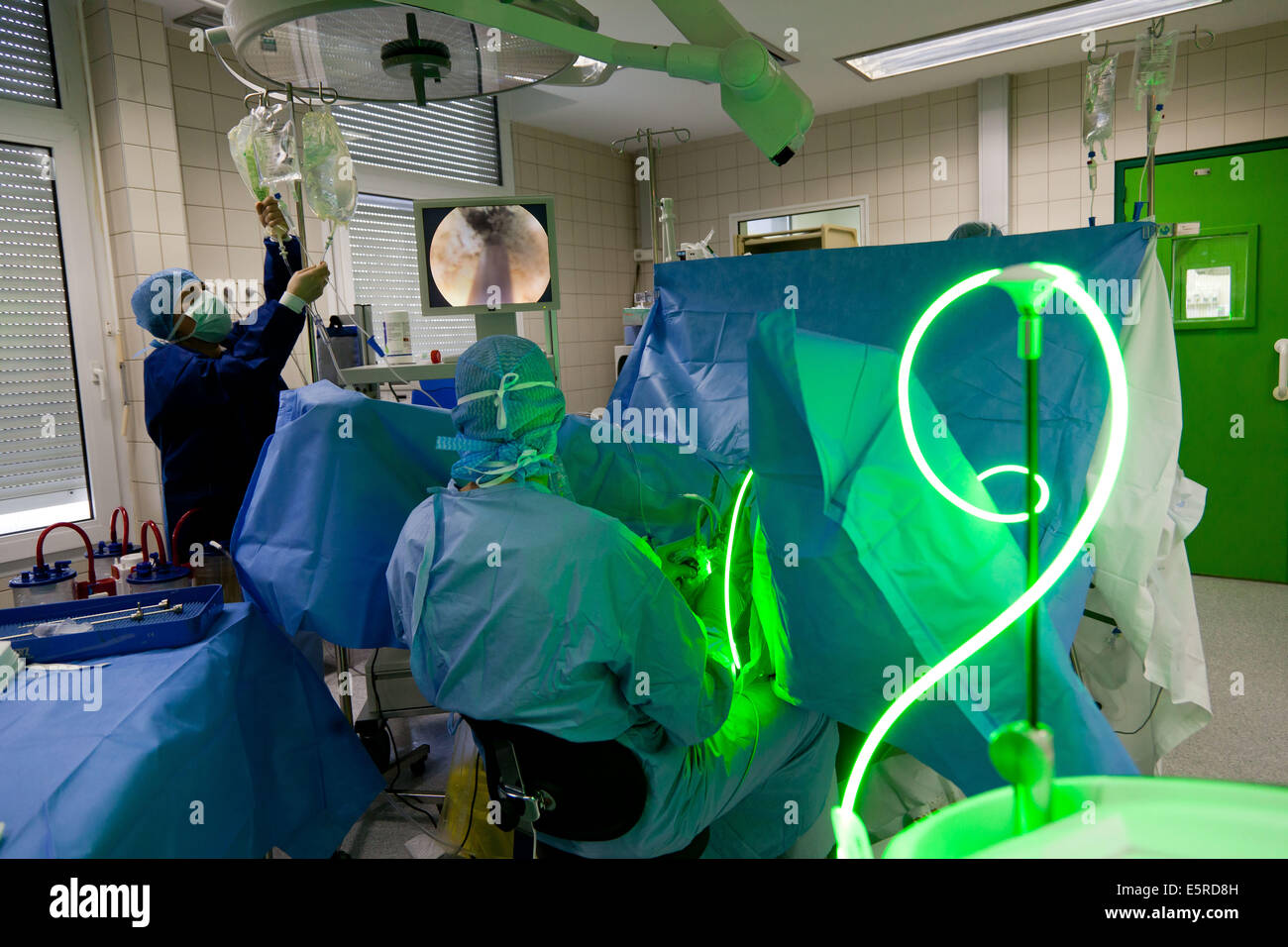 Le traitement de l'Hyperplasie prostatique) par Photoselective vaporisation de la prostate (PVP) à l'aide de la PV Greenlight Banque D'Images