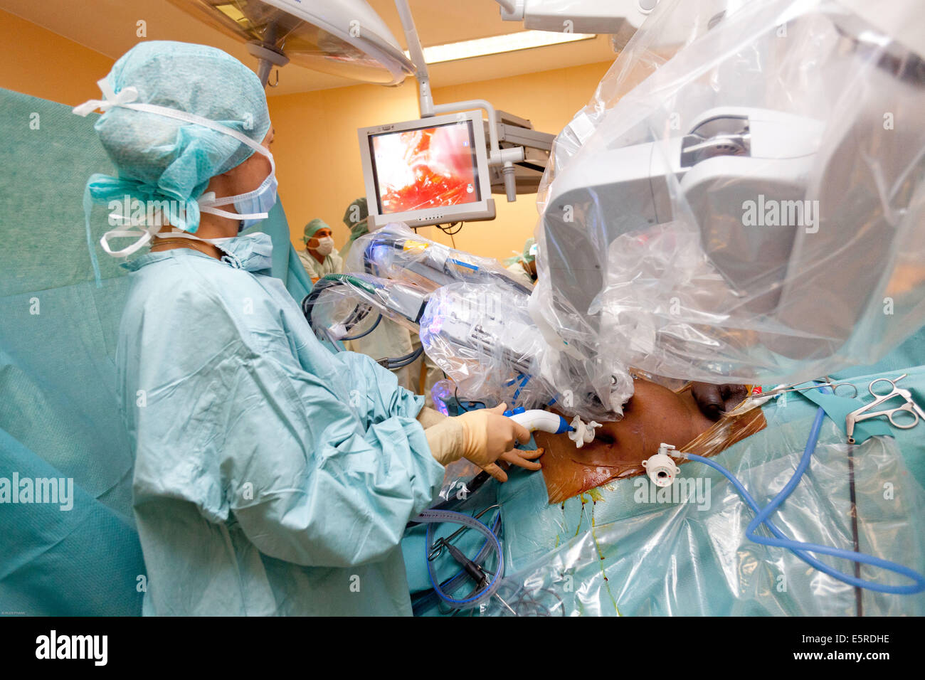 Prostatectomie radicale effectuée par le robot da Vinci de la téléchirurgie, dont quatre bras articulés et appareil photo sont contrôlés à distance par Banque D'Images