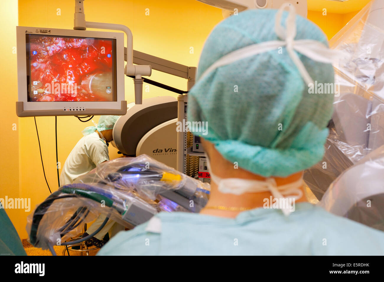 Prostatectomie radicale effectuée par le robot da Vinci de la téléchirurgie, dont quatre bras articulés et appareil photo sont contrôlés à distance par Banque D'Images