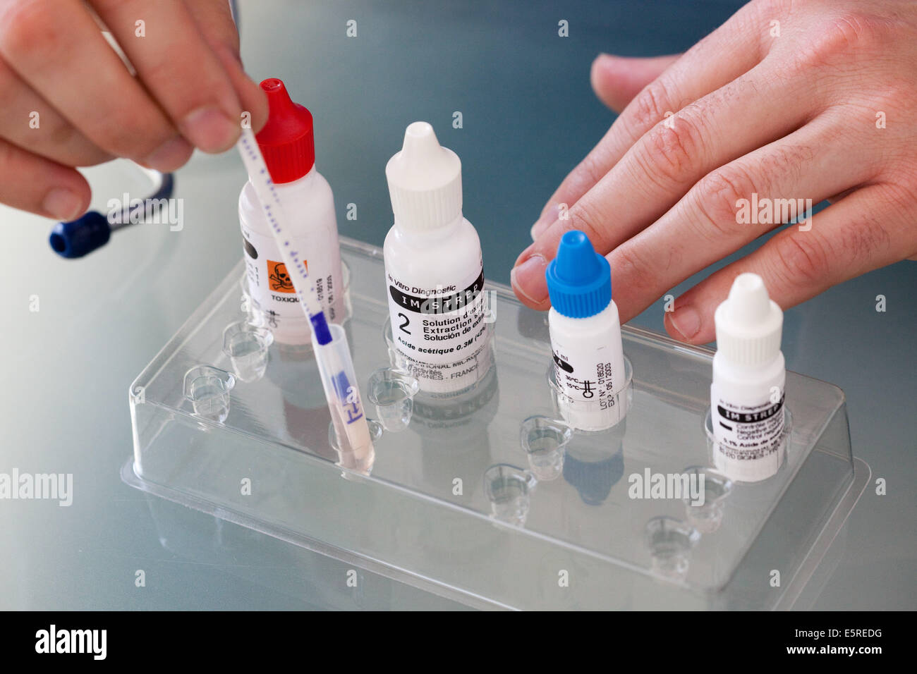 Test de diagnostic pour déterminer l'origine virale ou bactérienne ...