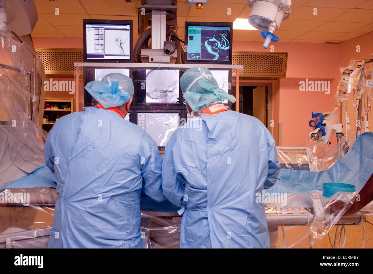 Traitement de la sténose carotidienne par angioplastie et stent réglage prothèse, ici, d'un cathéter inséré dans une veine sous Banque D'Images