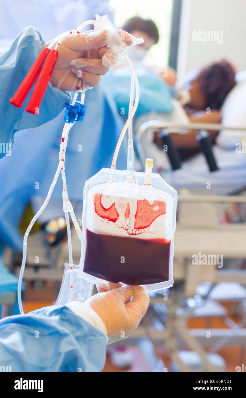 Le sang de cordon ombilical pour le prélèvement des cellules souches. Sac de sang placentaire. Obstétrique et gynécologie, Hôpital de Limoges, Banque D'Images