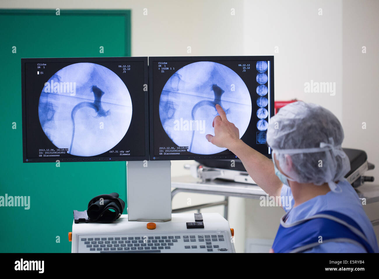 Un ureterorenoscopy laser flexible, lithotripsie, un ureterorenoscope est introduit par l'urètre de pulvériser Banque D'Images